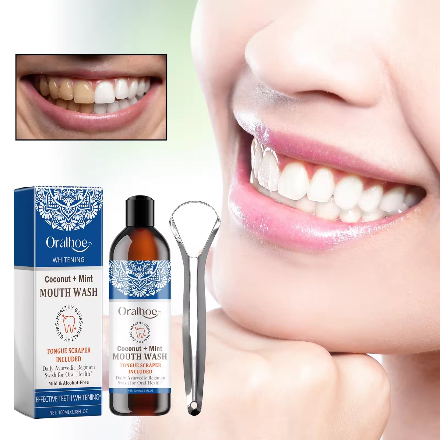 Coconut Mint Mouthwash for Fresh Breath – Natural Coconut & Mint Formula to Fight Bad Breath, Promote Healthy Gums & Teeth Whitening, Alcohol-Free Oral Care (100ml)